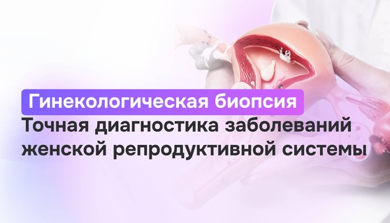 Гинекологическая биопсия: виды, подготовка, результаты