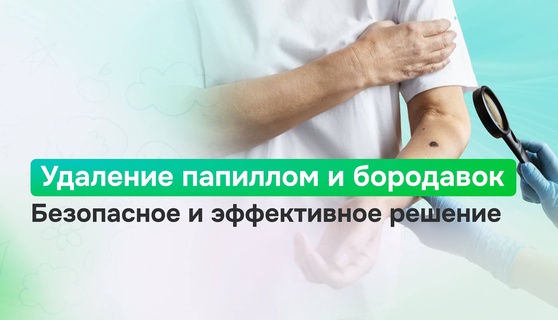 Удаление папиллом и бородавок в Иркутске: методы, безопасность и уход после процедуры